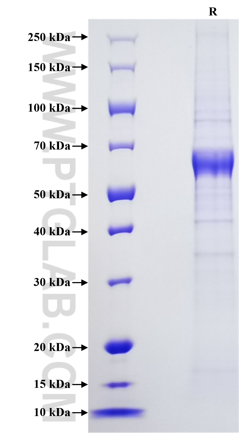 Purity of Recombinant Human LAG-3 was determined by SDS-PAGE. The protein was resolved in an SDS-PAGE in reducing (R) conditions and stained using Coomassie blue.