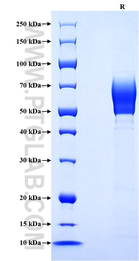 Purity of Recombinant Mouse IL18BP was determined by SDS-PAGE. The protein was resolved in an SDS-PAGE in reducing (R) conditions and stained using Coomassie blue.