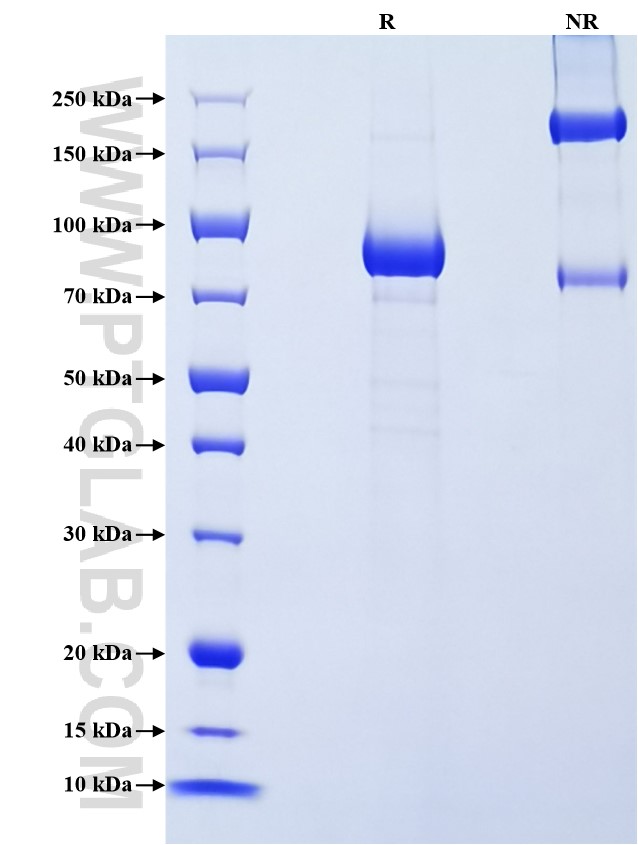 Purity of Recombinant Mouse LBP was determined by SDS-PAGE. The protein was resolved in an SDS-PAGE in reducing (R) and non-reducing (NR) conditions and stained using Coomassie blue. Purity of Recombinant Mouse LBP was determined by SDS-PAGE. The protein was resolved in an SDS-PAGE in reducing (R) and non-reducing (NR) conditions and stained using Coomassie blue.