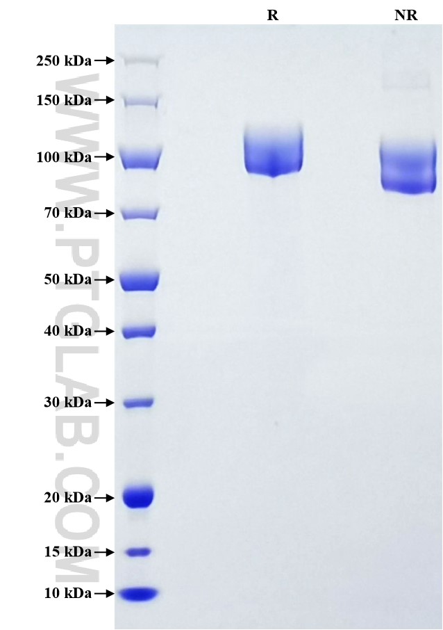 Purity of Recombinant Human NCAM-1 was determined by SDS-PAGE. The protein was resolved in an SDS-PAGE in reducing (R) and non-reducing (NR) conditions and stained using Coomassie blue.