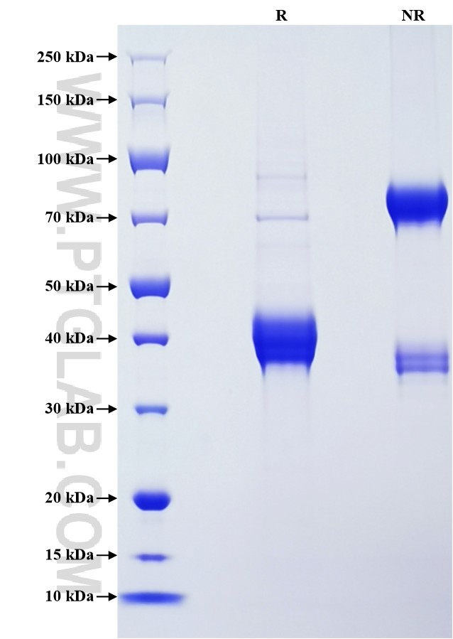 Purity of Recombinant Human PTH was determined by SDS-PAGE. The protein was resolved in an SDS-PAGE in reducing (R) and non-reducing (NR) conditions and stained using Coomassie blue.