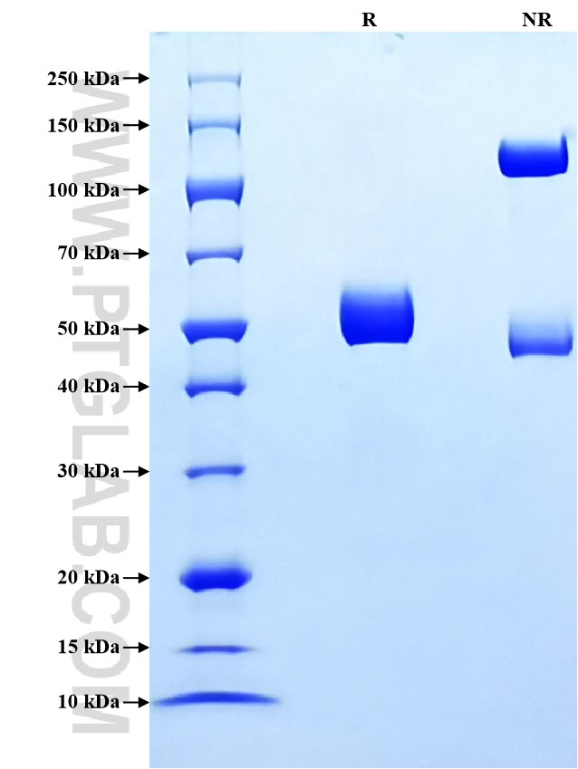 Purity of Recombinant Human Neutrophil Elastase was determined by SDS-PAGE. The protein was resolved in an SDS-PAGE in reducing (R) and non-reducing (NR) conditions and stained using Coomassie blue.