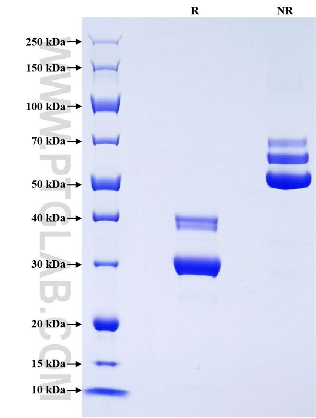 Purity of Recombinant Rat CXCL10 was determined by SDS-PAGE. The protein was resolved in an SDS-PAGE in reducing (R) and non-reducing (NR) conditions and stained using Coomassie blue.