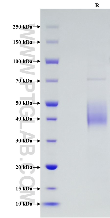 Purity of Recombinant Human CD48 was determined by SDS-PAGE. The protein was resolved in an SDS-PAGE in reducing (R) conditions and stained using Coomassie blue. Purity of Recombinant Human CD48 was determined by SDS-PAGE. The protein was resolved in an SDS-PAGE in reducing (R) conditions and stained using Coomassie blue.