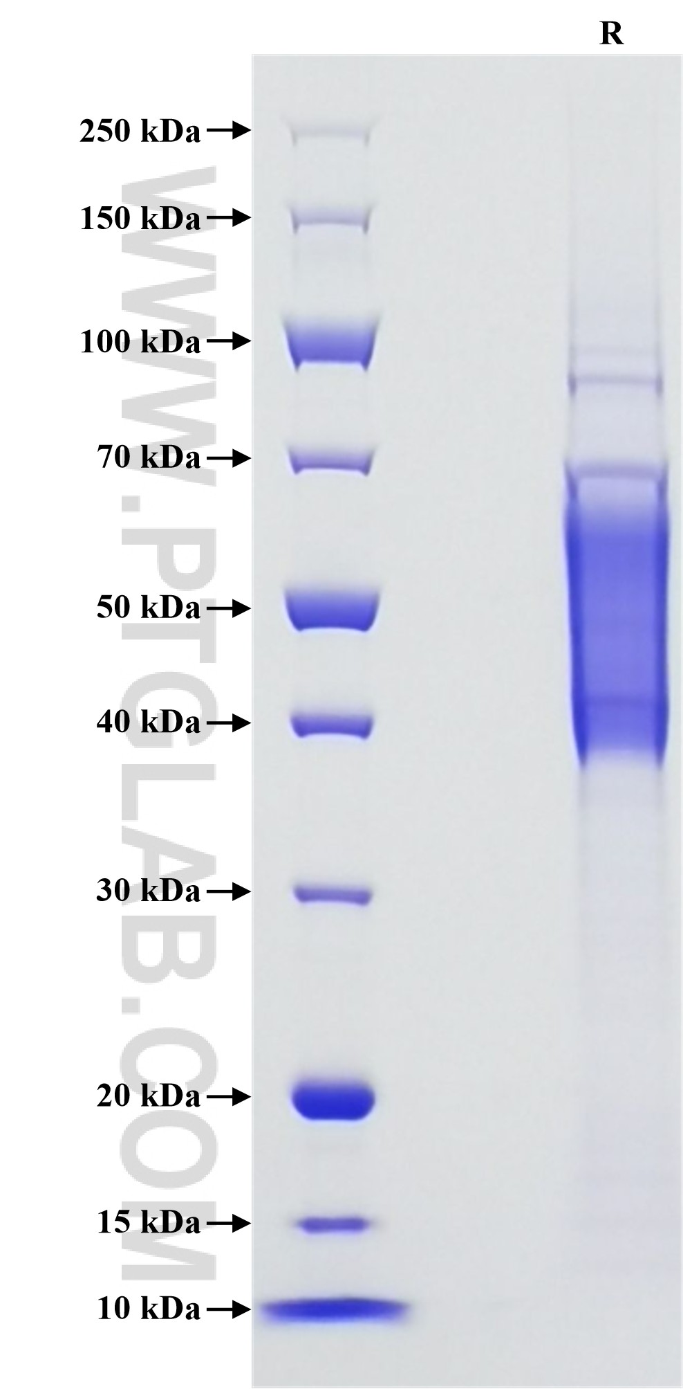 Purity of Recombinant Human CD244 was determined by SDS-PAGE. The protein was resolved in an SDS-PAGE in reducing (R) and non-reducing (NR) conditions and stained using Coomassie blue.