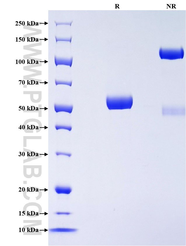 Purity of Recombinant Rat TIMP-1 was determined by SDS-PAGE. The protein was resolved in an SDS-PAGE in reducing (R) and non-reducing (NR) conditions and stained using Coomassie blue.