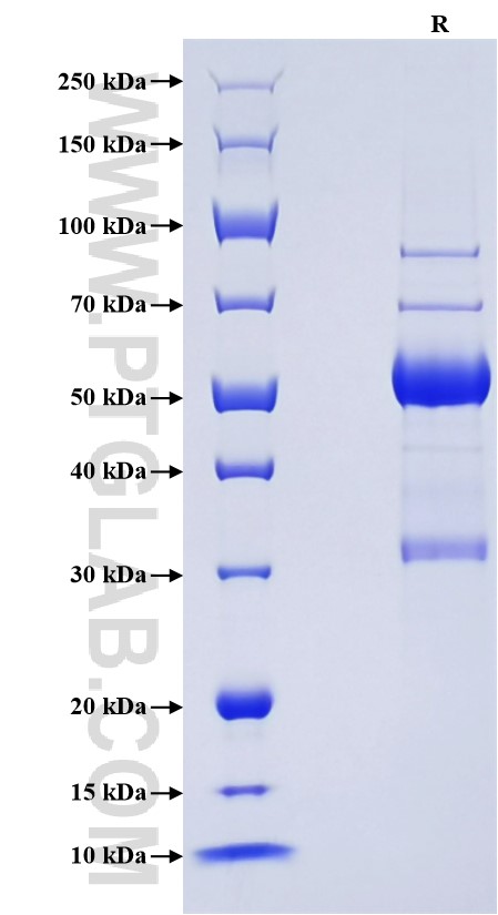 Purity of Recombinant Rat Fas Ligand was determined by SDS-PAGE. The protein was resolved in an SDS-PAGE in reducing (R) conditions and stained using Coomassie blue. Purity of Recombinant Rat Fas Ligand was determined by SDS-PAGE. The protein was resolved in an SDS-PAGE in reducing (R) conditions and stained using Coomassie blue.