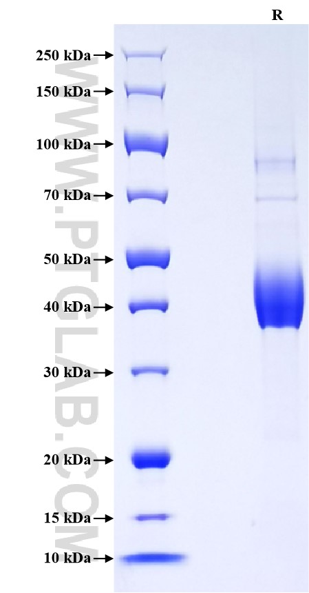 Purity of Recombinant Rat CD59 was determined by SDS-PAGE. The protein was resolved in an SDS-PAGE in reducing (R) conditions and stained using Coomassie blue. Purity of Recombinant Rat CD59 was determined by SDS-PAGE. The protein was resolved in an SDS-PAGE in reducing (R) conditions and stained using Coomassie blue.