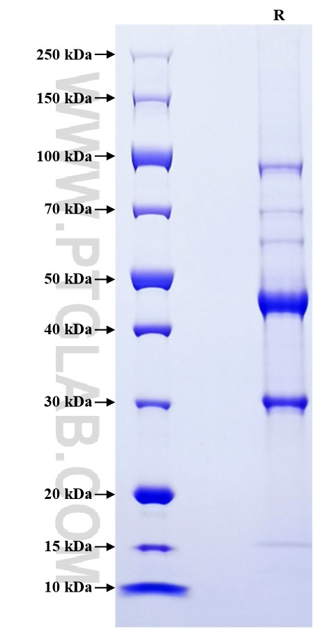 Purity of Recombinant Human IL-32 was determined by SDS-PAGE. The protein was resolved in an SDS-PAGE in reducing (R) conditions and stained using Coomassie blue.