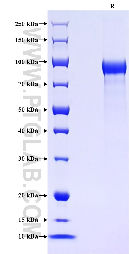 Purity of Recombinant Rat Progranulin was determined by SDS-PAGE. The protein was resolved in an SDS-PAGE in reducing (R) conditions and stained using Coomassie blue. Purity of Recombinant Rat Progranulin was determined by SDS-PAGE. The protein was resolved in an SDS-PAGE in reducing (R) conditions and stained using Coomassie blue.