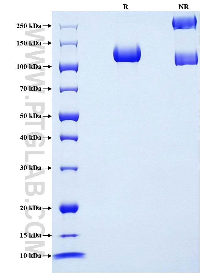 Purity of Recombinant Rat NCAM-1 was determined by SDS-PAGE. The protein was resolved in an SDS-PAGE in reducing (R) and non-reducing (NR) conditions and stained using Coomassie blue. Purity of Recombinant Rat NCAM-1 was determined by SDS-PAGE. The protein was resolved in an SDS-PAGE in reducing (R) and non-reducing (NR) conditions and stained using Coomassie blue.