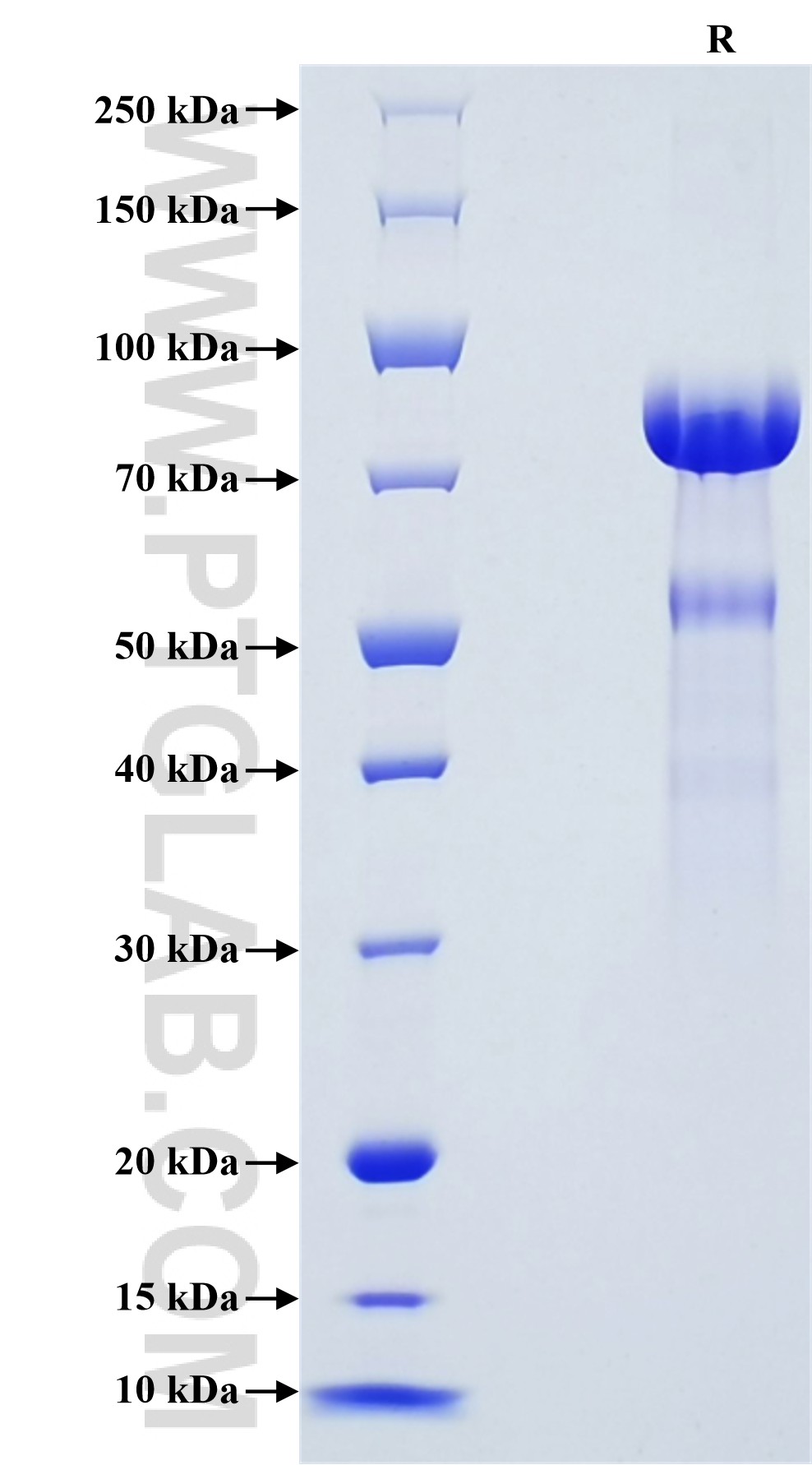 Purity of Recombinant Rat Osteopontin was determined by SDS-PAGE. The protein was resolved in an SDS-PAGE in reducing (R) conditions and stained using Coomassie blue. Purity of Recombinant Rat Osteopontin was determined by SDS-PAGE. The protein was resolved in an SDS-PAGE in reducing (R) conditions and stained using Coomassie blue.