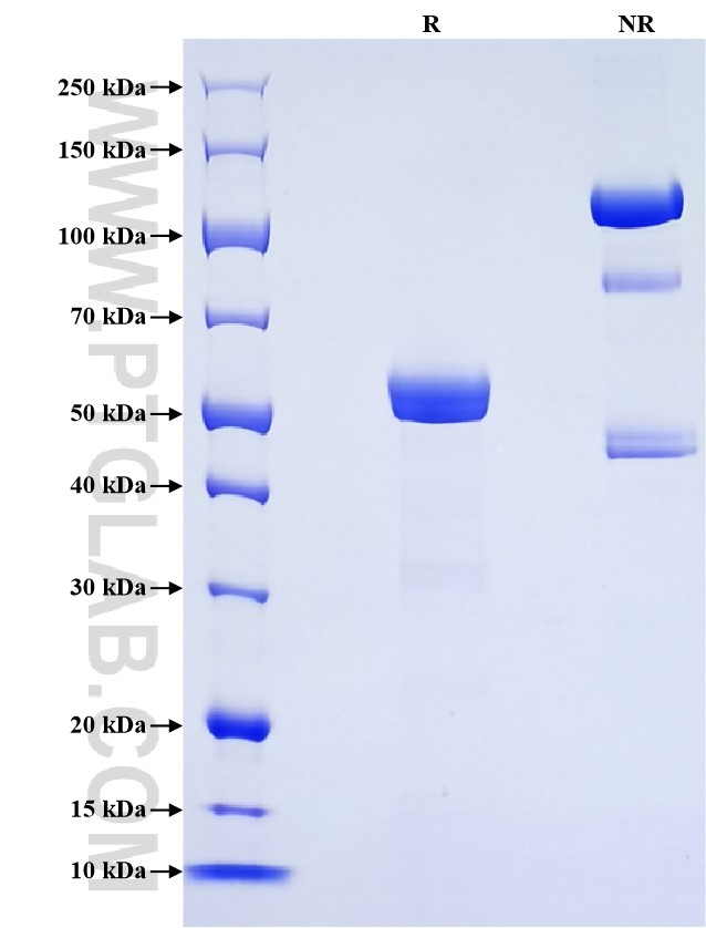 Purity of Recombinant Rat CTRB1 was determined by SDS-PAGE. The protein was resolved in an SDS-PAGE in reducing (R) and non-reducing (NR) conditions and stained using Coomassie blue.