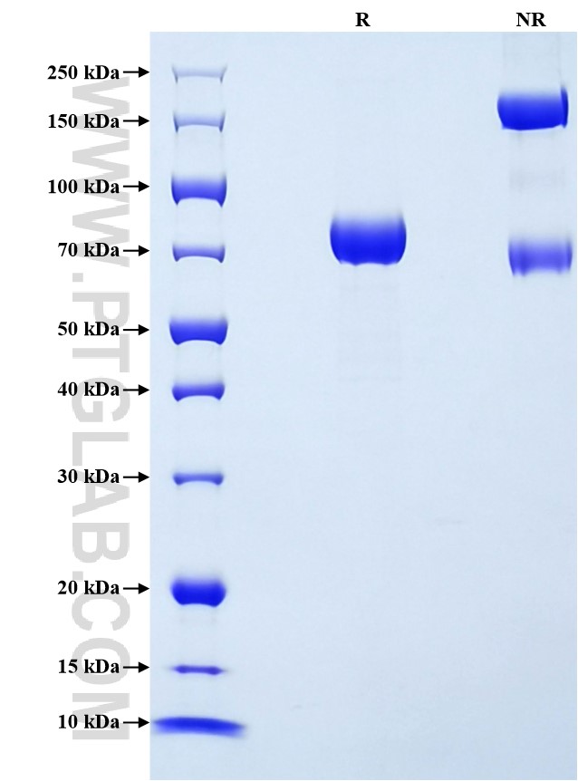 Purity of Recombinant Rat PAI-1 was determined by SDS-PAGE. The protein was resolved in an SDS-PAGE in reducing (R) and non-reducing (NR) conditions and stained using Coomassie blue.