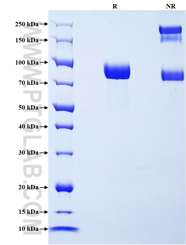 Purity of Recombinant Rat Hemopexin was determined by SDS-PAGE. The protein was resolved in an SDS-PAGE in reducing (R) and non-reducing (NR) conditions and stained using Coomassie blue.