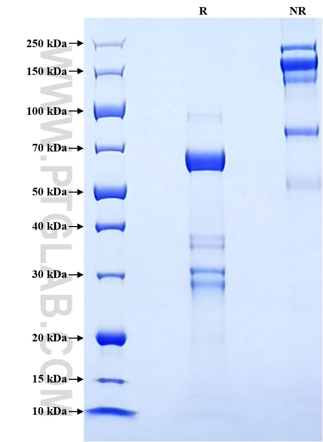 Purity of Recombinant Rat t-Plasminogen activator was determined by SDS-PAGE. The protein was resolved in an SDS-PAGE in reducing (R) and non-reducing (NR) conditions and stained using Coomassie blue. Purity of Recombinant Rat t-Plasminogen activator was determined by SDS-PAGE. The protein was resolved in an SDS-PAGE in reducing (R) and non-reducing (NR) conditions and stained using Coomassie blue.