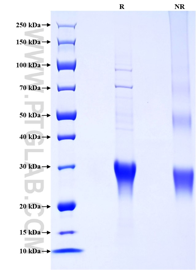Purity of Recombinant Rabbit CD8B was determined by SDS-PAGE. The protein was resolved in an SDS-PAGE in reducing (R) and non-reducing (NR) conditions and stained using Coomassie blue. Purity of Recombinant Rabbit CD8B was determined by SDS-PAGE. The protein was resolved in an SDS-PAGE in reducing (R) and non-reducing (NR) conditions and stained using Coomassie blue.