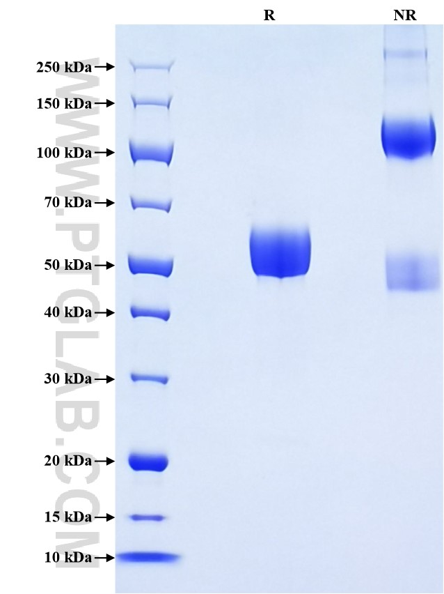 Purity of Recombinant Mouse CD8A was determined by SDS-PAGE. The protein was resolved in an SDS-PAGE in reducing (R) and non-reducing (NR) conditions and stained using Coomassie blue.