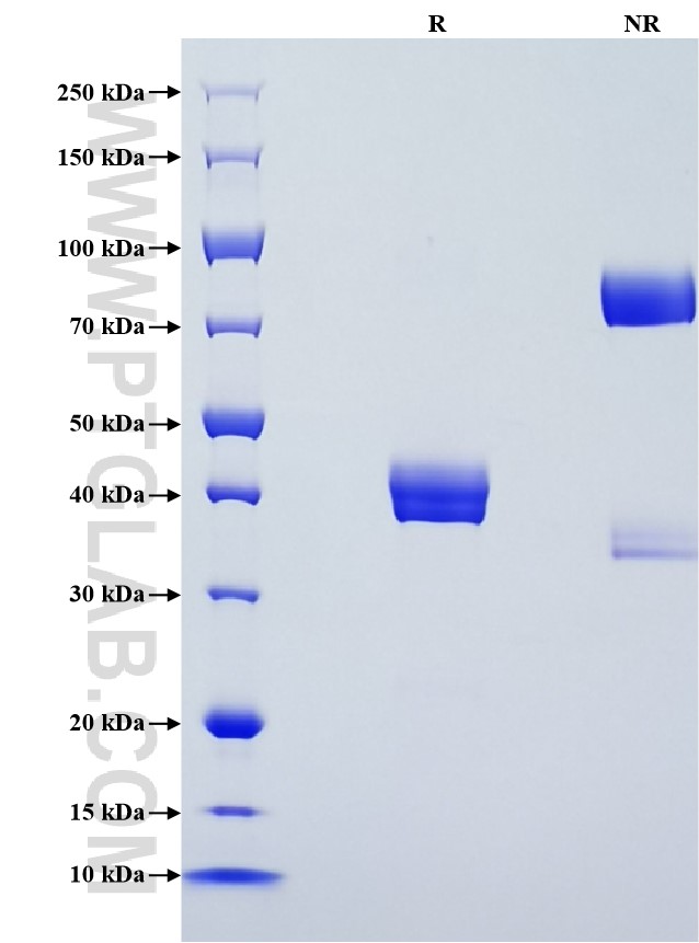 Purity of Recombinant Rat Beta-2-Microglobulin was determined by SDS-PAGE. The protein was resolved in an SDS-PAGE in reducing (R) and non-reducing (NR) conditions and stained using Coomassie blue.