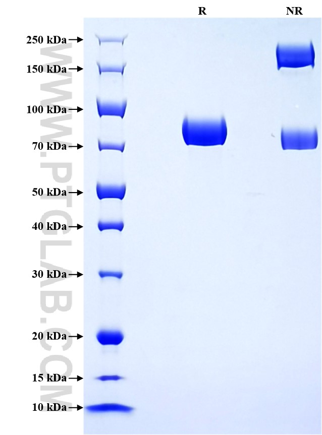 Purity of Recombinant Rat Angiotensinogen was determined by SDS-PAGE. The protein was resolved in an SDS-PAGE in reducing (R) and non-reducing (NR) conditions and stained using Coomassie blue. Purity of Recombinant Rat Angiotensinogen was determined by SDS-PAGE. The protein was resolved in an SDS-PAGE in reducing (R) and non-reducing (NR) conditions and stained using Coomassie blue.