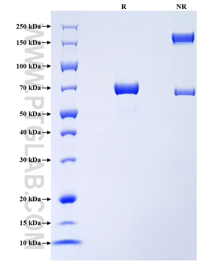 Purity of Recombinant Rat Carboxypeptidase A was determined by SDS-PAGE. The protein was resolved in an SDS-PAGE in reducing (R) and non-reducing (NR) conditions and stained using Coomassie blue.