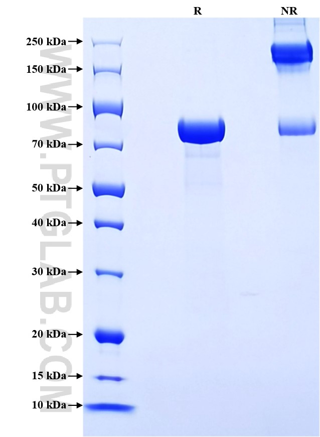 Purity of Recombinant Rat MMP-8 was determined by SDS-PAGE. The protein was resolved in an SDS-PAGE in reducing (R) and non-reducing (NR) conditions and stained using Coomassie blue.