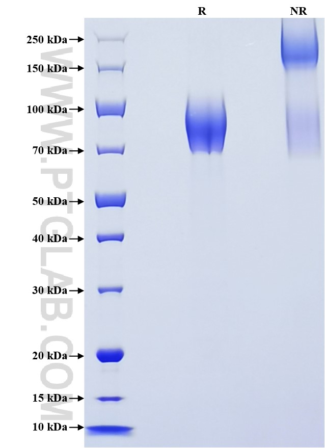 Purity of Recombinant Rat CX3CL1 was determined by SDS-PAGE. The protein was resolved in an SDS-PAGE in reducing (R) and non-reducing (NR) conditions and stained using Coomassie blue. Purity of Recombinant Rat CX3CL1 was determined by SDS-PAGE. The protein was resolved in an SDS-PAGE in reducing (R) and non-reducing (NR) conditions and stained using Coomassie blue.