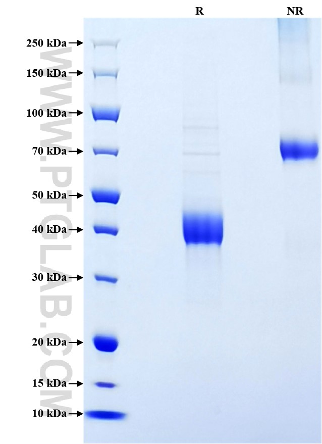 Purity of Recombinant Mouse CCL1 was determined by SDS-PAGE. The protein was resolved in an SDS-PAGE in reducing (R) and non-reducing (NR) conditions and stained using Coomassie blue.