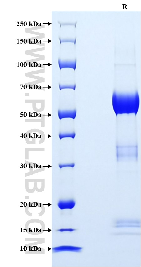 Purity of Recombinant Mouse SOST was determined by SDS-PAGE. The protein was resolved in an SDS-PAGE in reducing (R) conditions and stained using Coomassie blue.