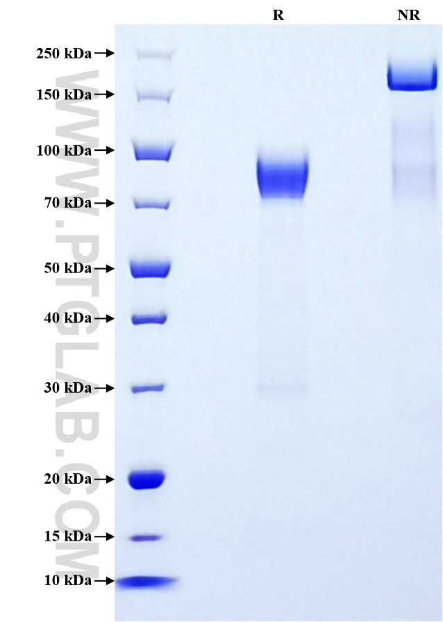 Purity of Recombinant Mouse Timd4 was determined by SDS-PAGE. The protein was resolved in an SDS-PAGE in reducing (R) and non-reducing (NR) conditions and stained using Coomassie blue.