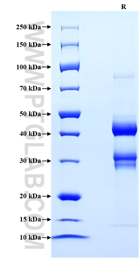 Purity of Recombinant Mouse CXCL9 was determined by SDS-PAGE. The protein was resolved in an SDS-PAGE in reducing (R) conditions and stained using Coomassie blue.
