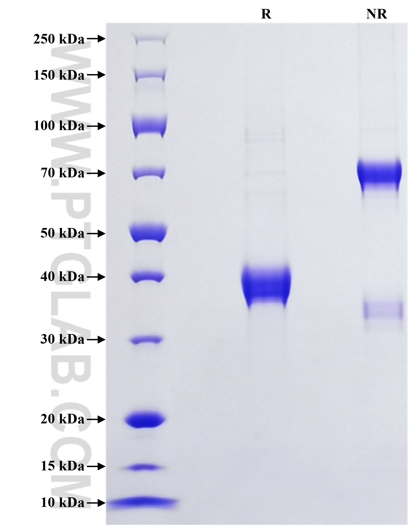 Purity of Recombinant Mouse CCL17 was determined by SDS-PAGE. The protein was resolved in an SDS-PAGE in reducing (R) and non-reducing (NR) conditions and stained using Coomassie blue.