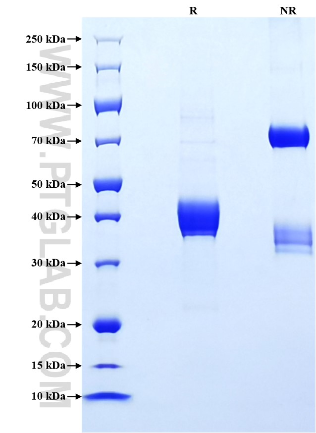 Purity of Recombinant Mouse C5 was determined by SDS-PAGE. The protein was resolved in an SDS-PAGE in reducing (R) and non-reducing (NR) conditions and stained using Coomassie blue.