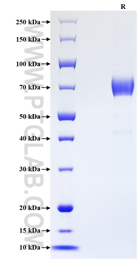 Purity of Recombinant Human CD19 was determined by SDS-PAGE. The protein was resolved in an SDS-PAGE in reducing (R) conditions and stained using Coomassie blue.