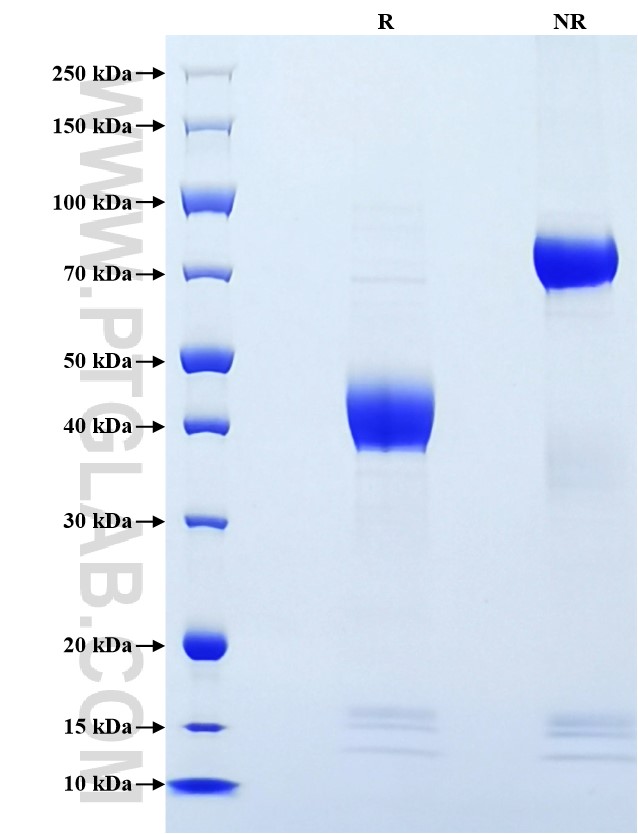Purity of Recombinant Mouse CCL9 was determined by SDS-PAGE. The protein was resolved in an SDS-PAGE in reducing (R) and non-reducing (NR) conditions and stained using Coomassie blue.