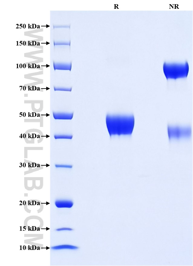 Purity of Recombinant Rat Cystatin C was determined by SDS-PAGE. The protein was resolved in an SDS-PAGE in reducing (R) and non-reducing (NR) conditions and stained using Coomassie blue. Purity of Recombinant Rat Cystatin C was determined by SDS-PAGE. The protein was resolved in an SDS-PAGE in reducing (R) and non-reducing (NR) conditions and stained using Coomassie blue.