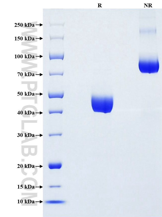 Purity of Recombinant Rat IL-17A was determined by SDS-PAGE. The protein was resolved in an SDS-PAGE in reducing (R) and non-reducing (NR) conditions and stained using Coomassie blue. Purity of Recombinant Rat IL-17A was determined by SDS-PAGE. The protein was resolved in an SDS-PAGE in reducing (R) and non-reducing (NR) conditions and stained using Coomassie blue.