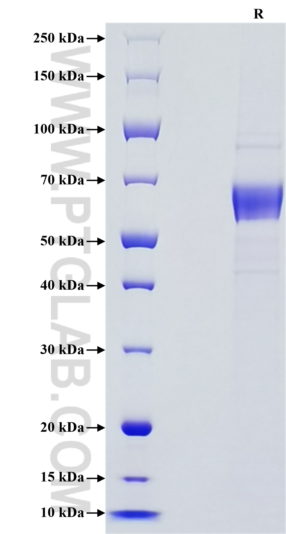 Purity of Recombinant Human IL-12A was determined by SDS-PAGE. The protein was resolved in an SDS-PAGE in reducing (R) conditions and stained using Coomassie blue. Purity of Recombinant Human IL-12A was determined by SDS-PAGE. The protein was resolved in an SDS-PAGE in reducing (R) conditions and stained using Coomassie blue.