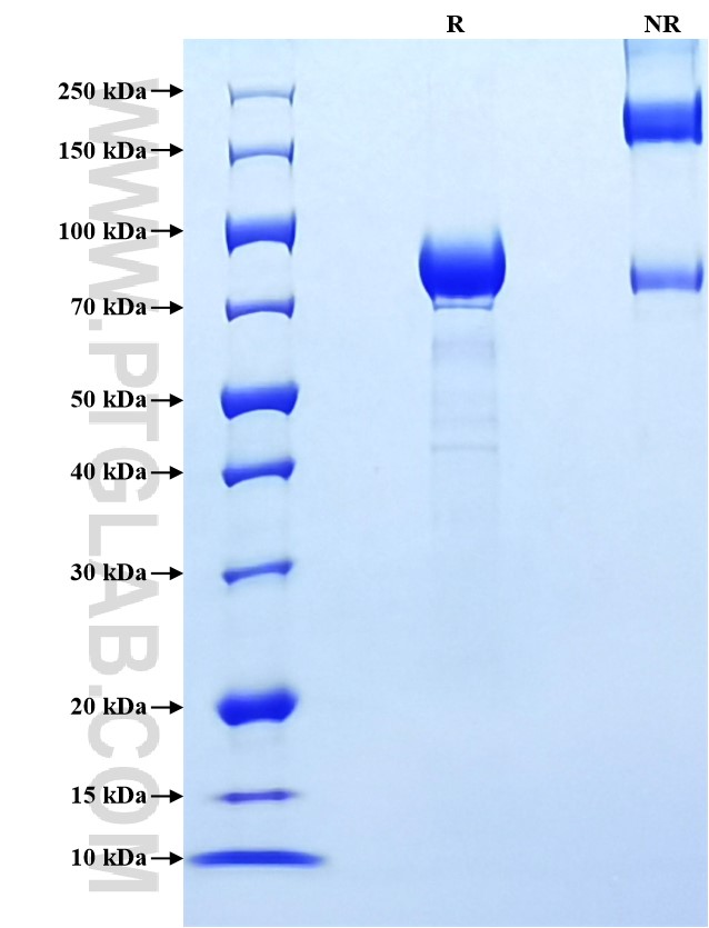 Purity of Recombinant Rat IL-6R alpha was determined by SDS-PAGE. The protein was resolved in an SDS-PAGE in reducing (R) and non-reducing (NR) conditions and stained using Coomassie blue. Purity of Recombinant Rat IL-6R alpha was determined by SDS-PAGE. The protein was resolved in an SDS-PAGE in reducing (R) and non-reducing (NR) conditions and stained using Coomassie blue.