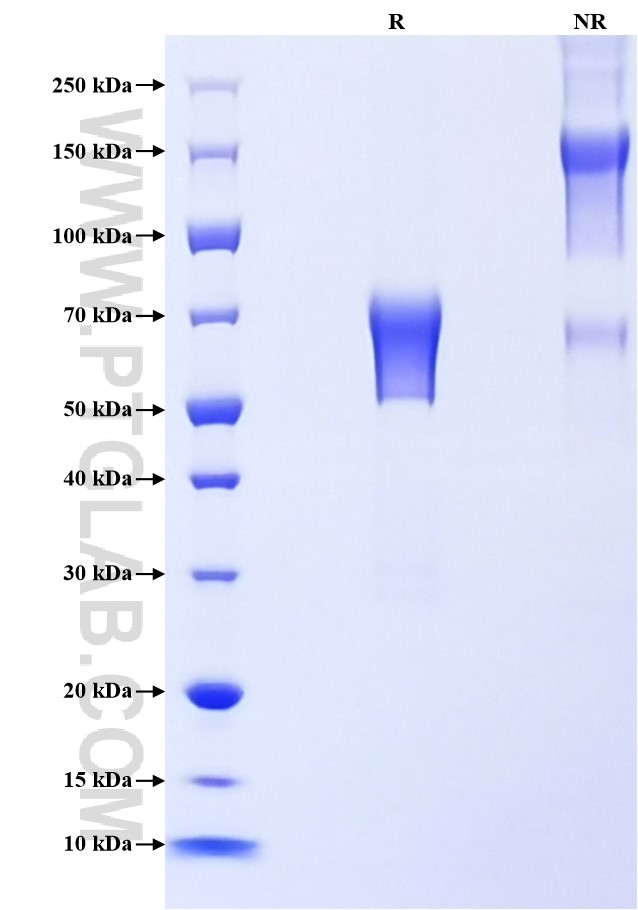 Purity of Recombinant Human TIM-3 was determined by SDS-PAGE. The protein was resolved in an SDS-PAGE in reducing (R) and non-reducing (NR) conditions and stained using Coomassie blue. Purity of Recombinant Human TIM-3 was determined by SDS-PAGE. The protein was resolved in an SDS-PAGE in reducing (R) and non-reducing (NR) conditions and stained using Coomassie blue.