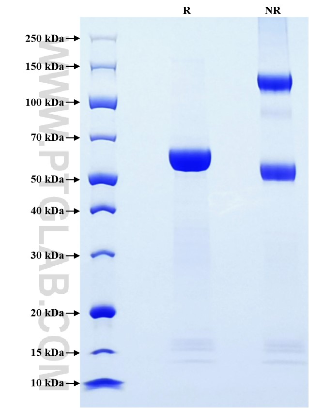 Purity of Recombinant Human Granzyme B was determined by SDS-PAGE. The protein was resolved in an SDS-PAGE in reducing (R) and non-reducing (NR) conditions and stained using Coomassie blue. Purity of Recombinant Human Granzyme B was determined by SDS-PAGE. The protein was resolved in an SDS-PAGE in reducing (R) and non-reducing (NR) conditions and stained using Coomassie blue.