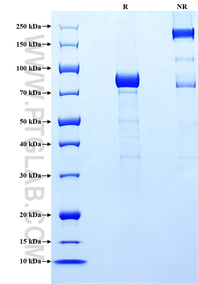 Purity of Recombinant Mouse IL-27 was determined by SDS-PAGE. The protein was resolved in an SDS-PAGE in reducing (R) and non-reducing (NR) conditions and stained using Coomassie blue. Purity of Recombinant Mouse IL-27 was determined by SDS-PAGE. The protein was resolved in an SDS-PAGE in reducing (R) and non-reducing (NR) conditions and stained using Coomassie blue.