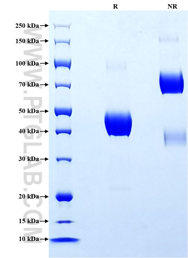 Purity of Recombinant Human hCG Alpha was determined by SDS-PAGE. The protein was resolved in an SDS-PAGE in reducing (R) and non-reducing (NR) conditions and stained using Coomassie blue. Purity of Recombinant Human hCG Alpha was determined by SDS-PAGE. The protein was resolved in an SDS-PAGE in reducing (R) and non-reducing (NR) conditions and stained using Coomassie blue.