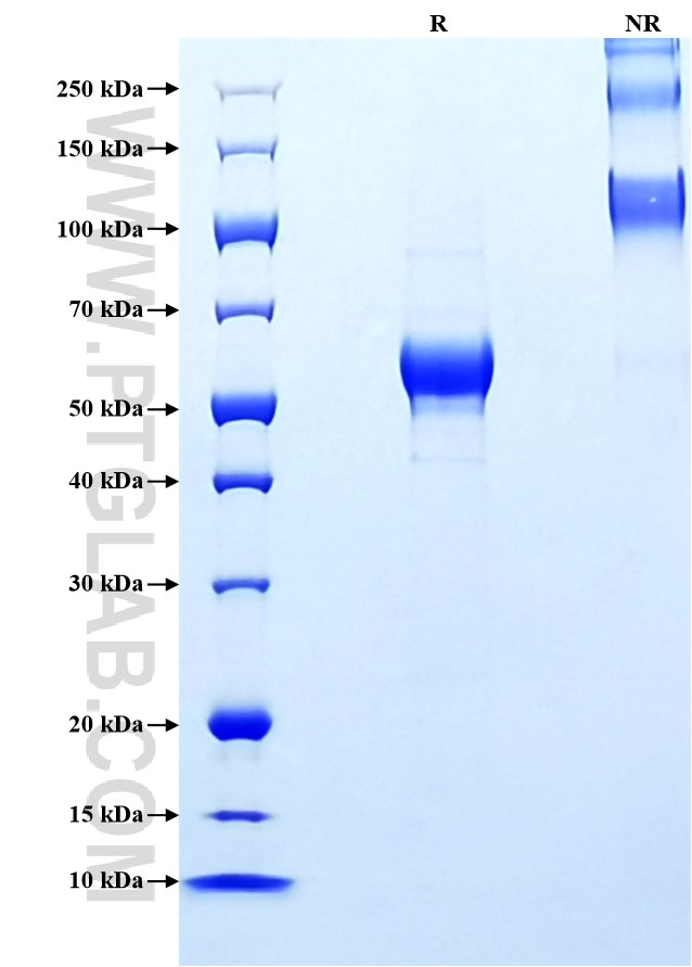 Purity of Recombinant Human hCG Beta was determined by SDS-PAGE. The protein was resolved in an SDS-PAGE in reducing (R) and non-reducing (NR) conditions and stained using Coomassie blue.