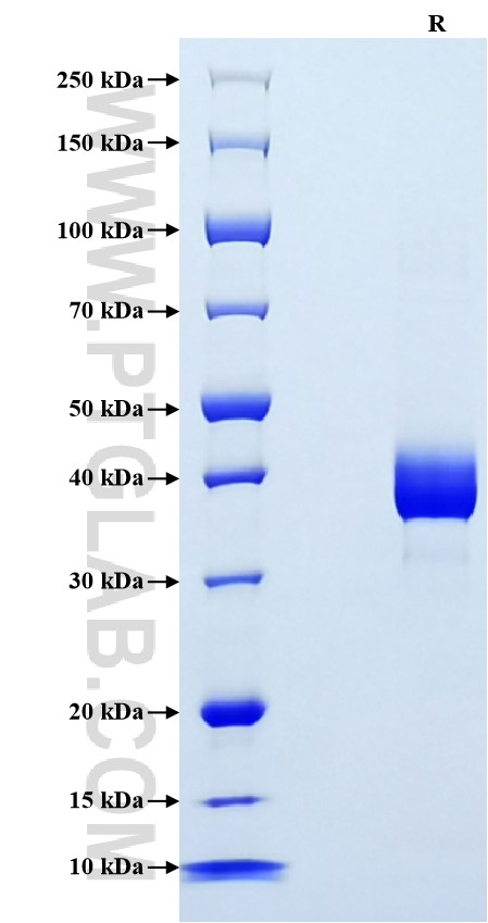 Purity of Recombinant Mouse Resistin was determined by SDS-PAGE. The protein was resolved in an SDS-PAGE in reducing (R) conditions and stained using Coomassie blue.