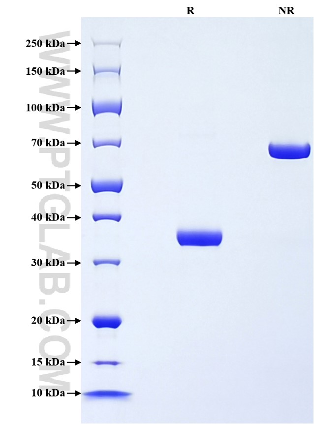 Purity of Recombinant Rat CXCL7 was determined by SDS-PAGE. The protein was resolved in an SDS-PAGE in reducing (R) and non-reducing (NR) conditions and stained using Coomassie blue.