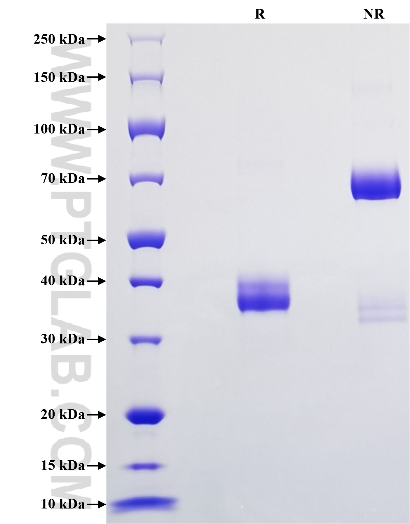 Purity of Recombinant Rat CXCL7 was determined by SDS-PAGE. The protein was resolved in an SDS-PAGE in reducing (R) and non-reducing (NR) conditions and stained using Coomassie blue.