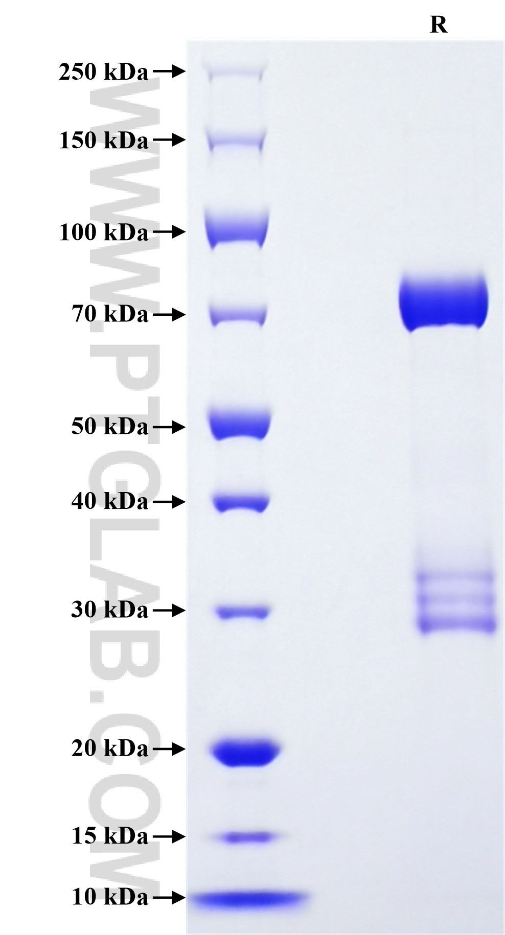 Purity of Recombinant Rat Serpin A12 was determined by SDS-PAGE. The protein was resolved in an SDS-PAGE in reducing (R) conditions and stained using Coomassie blue.