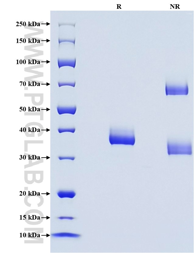 Purity of Recombinant Rat Resistin was determined by SDS-PAGE. The protein was resolved in an SDS-PAGE in reducing (R) and non-reducing (NR) conditions and stained using Coomassie blue. Purity of Recombinant Rat Resistin was determined by SDS-PAGE. The protein was resolved in an SDS-PAGE in reducing (R) and non-reducing (NR) conditions and stained using Coomassie blue.