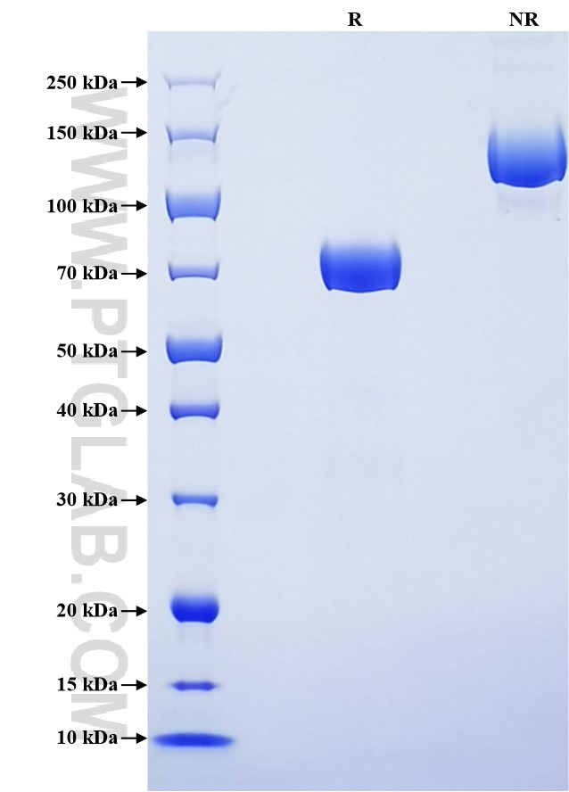 Purity of Recombinant Rat Lumican was determined by SDS-PAGE. The protein was resolved in an SDS-PAGE in reducing (R) and non-reducing (NR) conditions and stained using Coomassie blue. Purity of Recombinant Rat Lumican was determined by SDS-PAGE. The protein was resolved in an SDS-PAGE in reducing (R) and non-reducing (NR) conditions and stained using Coomassie blue.